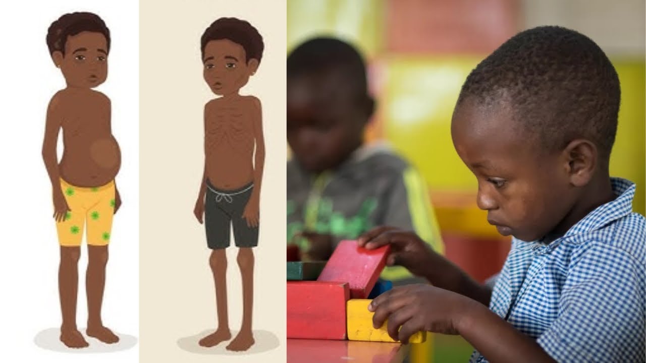 IBIRO UMWANA YAGAKWIRIYE KUBA AFITE KUVA 6mo Ku myaka IBIRI! Menya aho uwawe ahagaze!