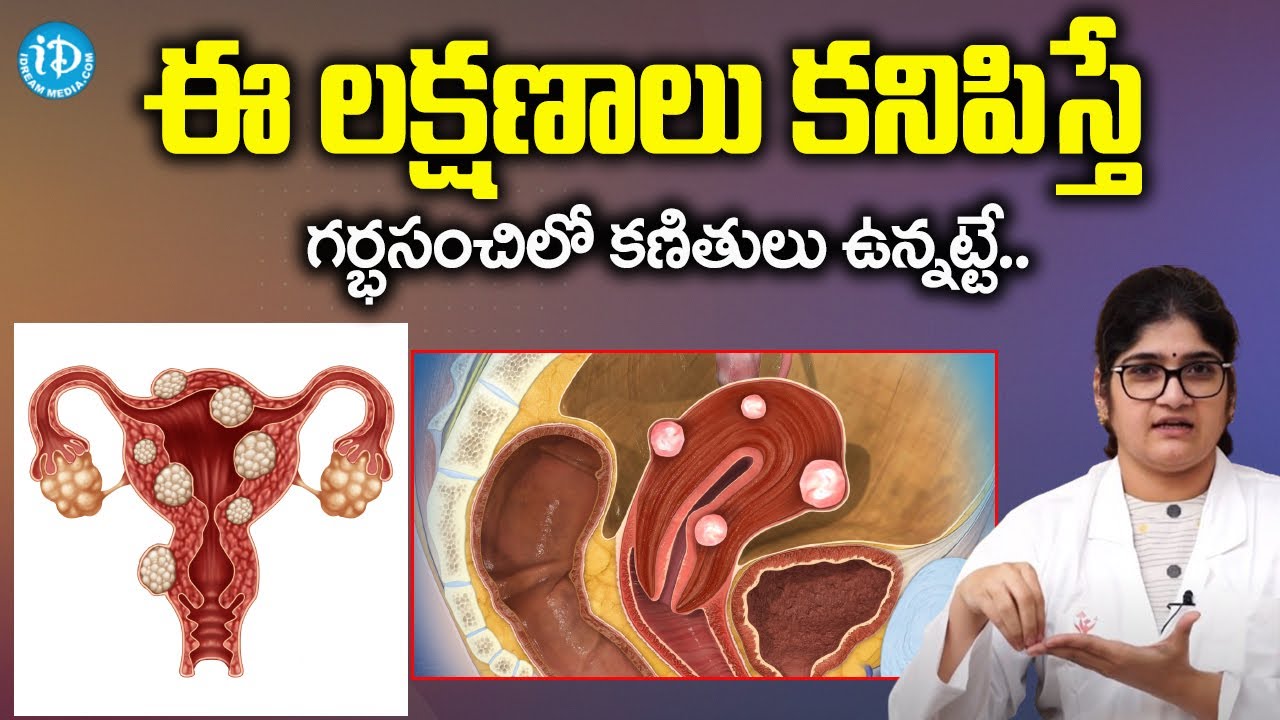 Symptoms of Uterine Fibroids In Telugu | iDream Health