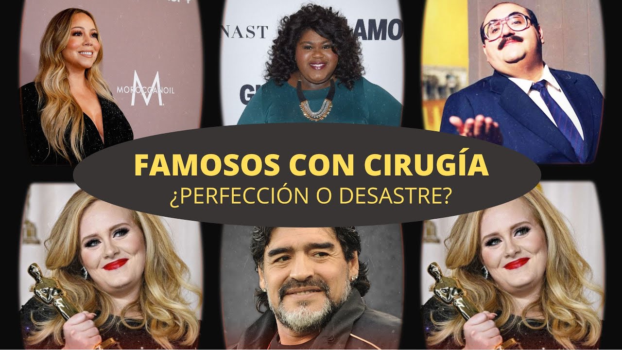 FAMOSOS con Bypass o Manga Gástrica  - CIRUGÍA BARIÁTRICA
