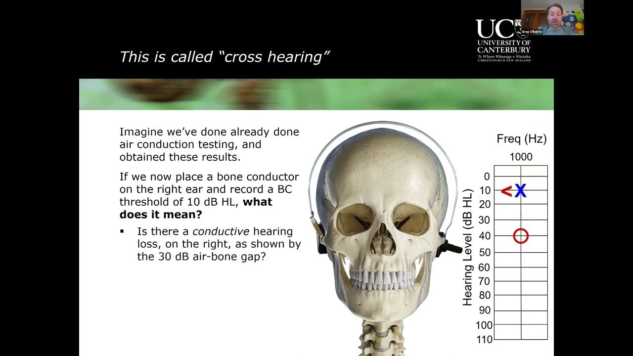 Clinical Masking in Audiology - A Beginner's Guide
