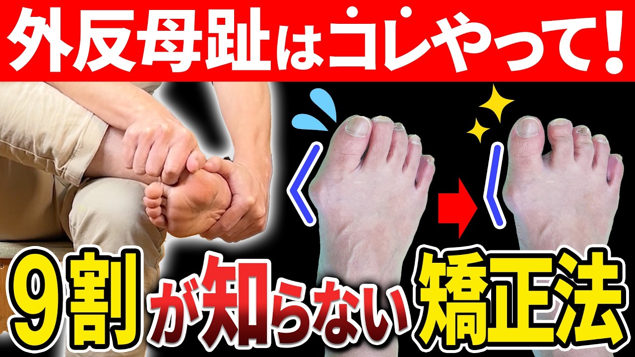 【外反母趾】9割の人が知らない外反母趾矯正の方法！親指の痛み、巻き爪に悩まないための対策【偏平足の治し方】