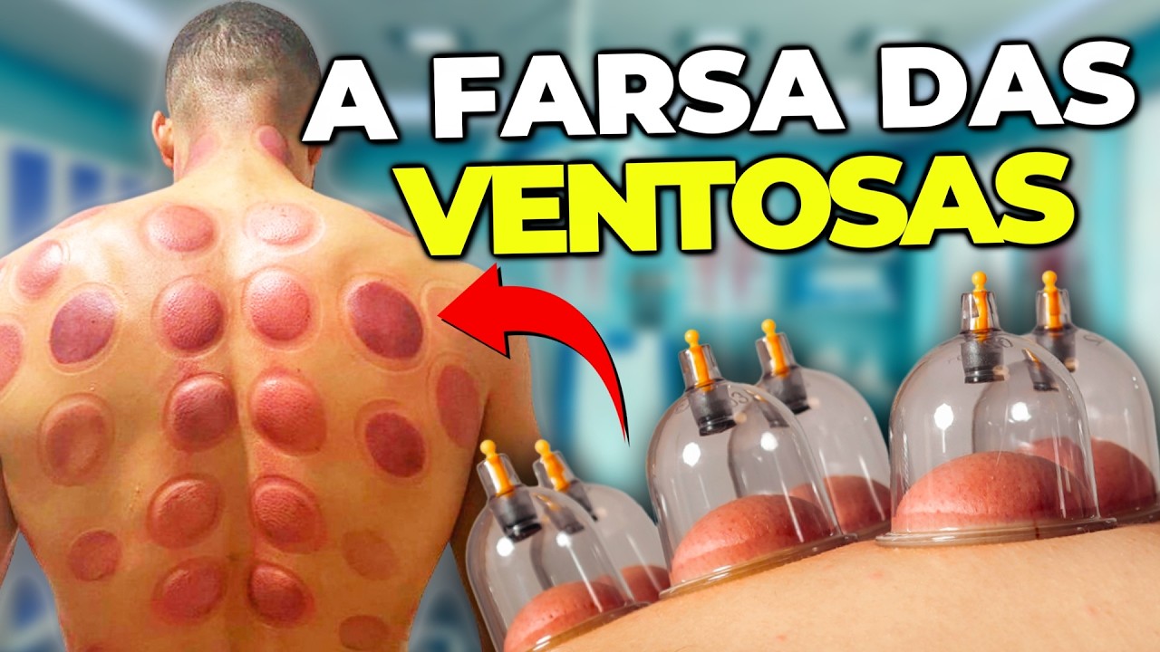A Verdade DOLOROSA sobre a VENTOSATERAPIA