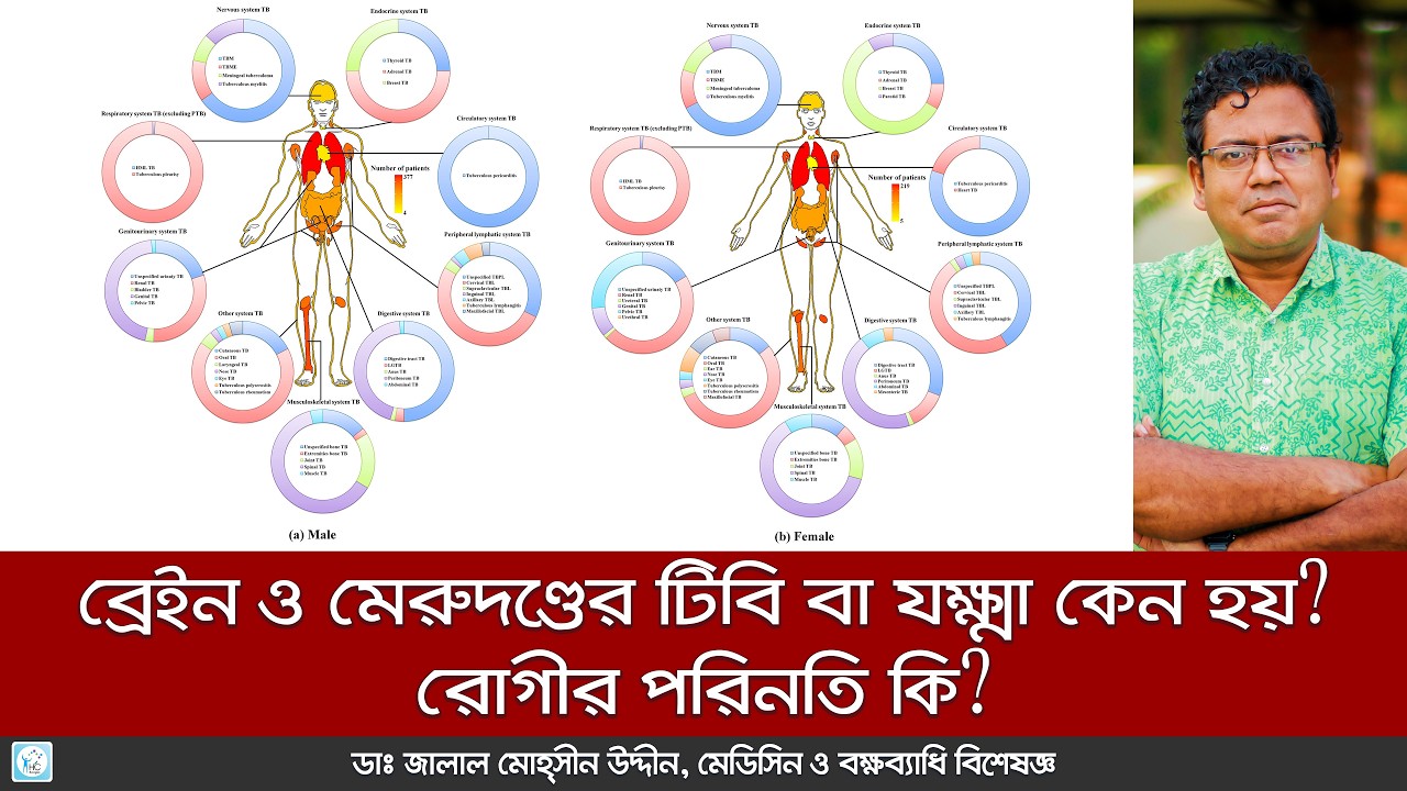 ব্রেইন ও মেরুদণ্ডের টিবি বা যক্ষ্মা কেন হয়? লক্ষণ ও আধুনিক চিকিৎসা | Brain and Spinal Cord TB Sympt