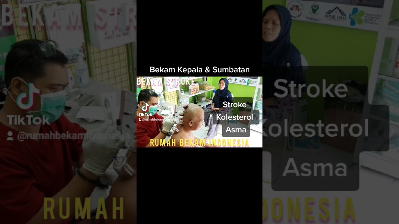 BEKAM KEPALA ,& SUMBATAN || KLINIK BEKAM JAKARTA || 085711839300