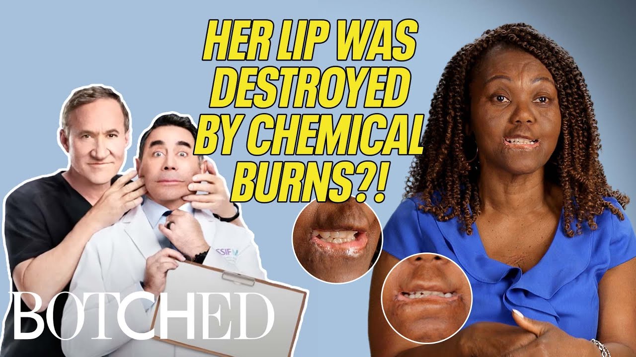 Jannie's Lip DISINTEGRATED After Being Fed Chemicals As A Baby?! (Before & After) | Botched | E!