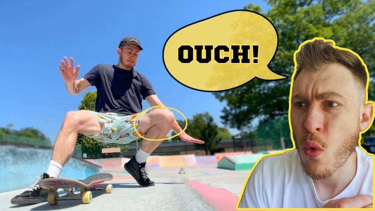 How to Fix Knee Pain! (Using Science)