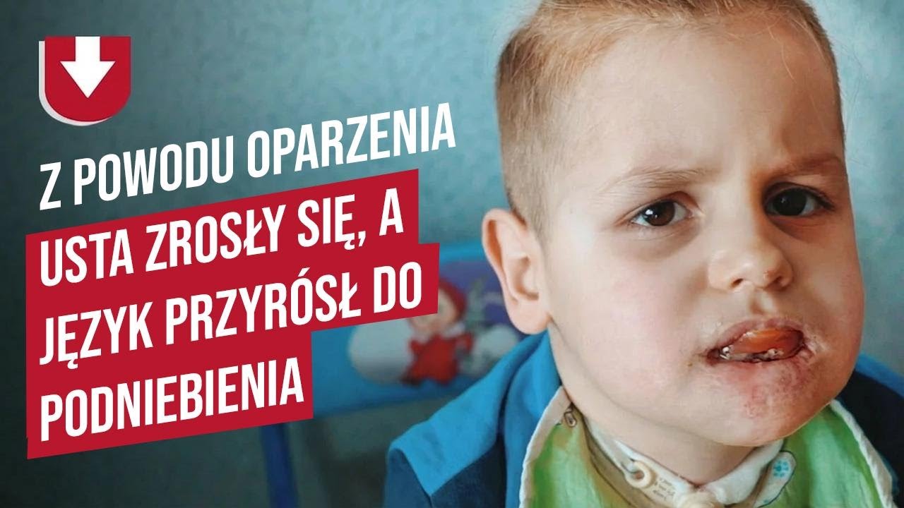 Mój syn wypił kwas – historia Kasi | Być mamą