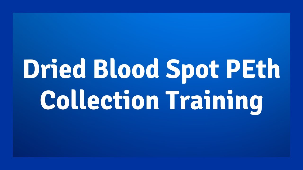 Dried Blood Spot PEth Collection Training