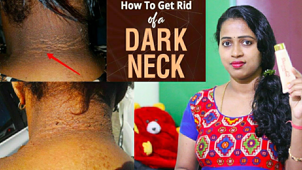 Best Neck Whitening Cream | Dermatologist suggestions | Mahathi Beauty Corner Tamil