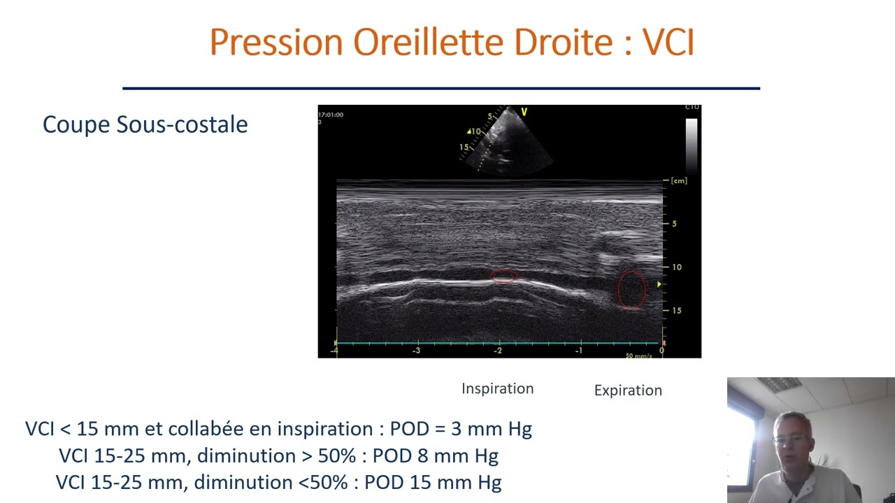 Evaluation de la fonction diastolique en échocardiographie transthoracique