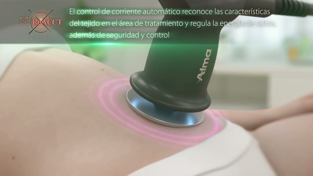 Alma PrimeX - Cómo funciona su nueva tecnología de ultrasonidos