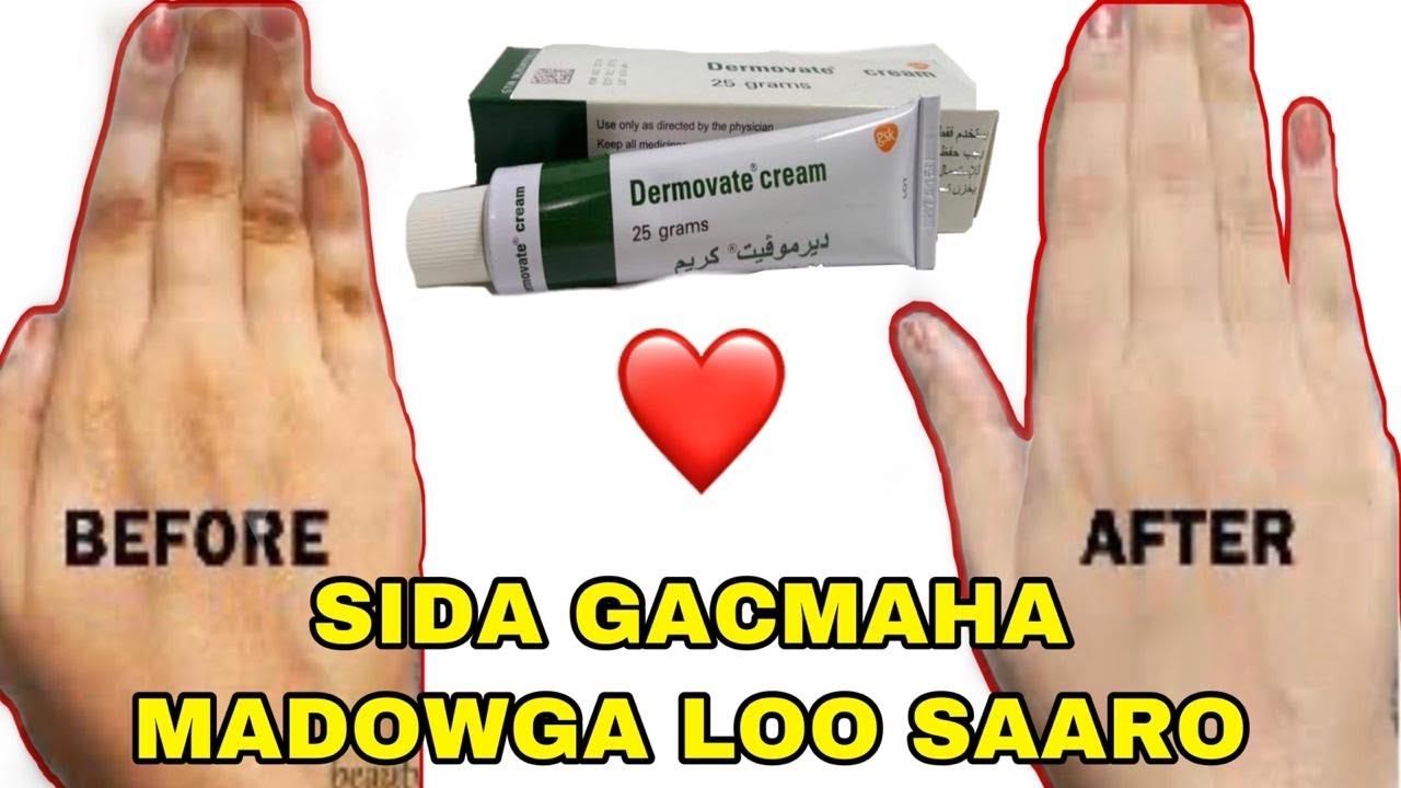 Sadax bari farahaga madowga wey ka saresa hada marsato