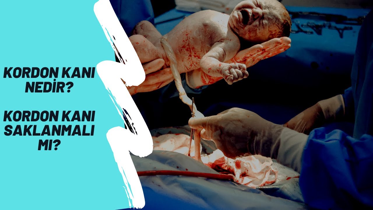 Kordon Kanını Saklamalı Mıyız? Kordon Kanı Hakkında Merak Ettikleriniz