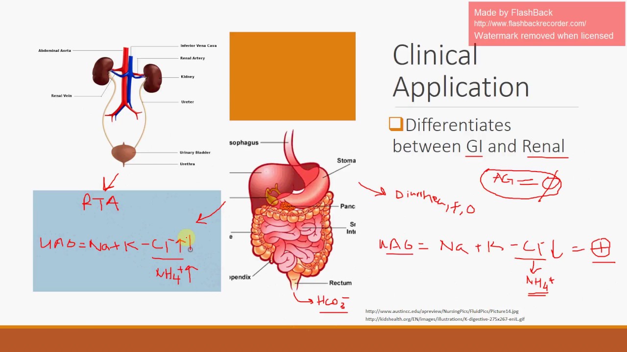 Urine Anion Gap