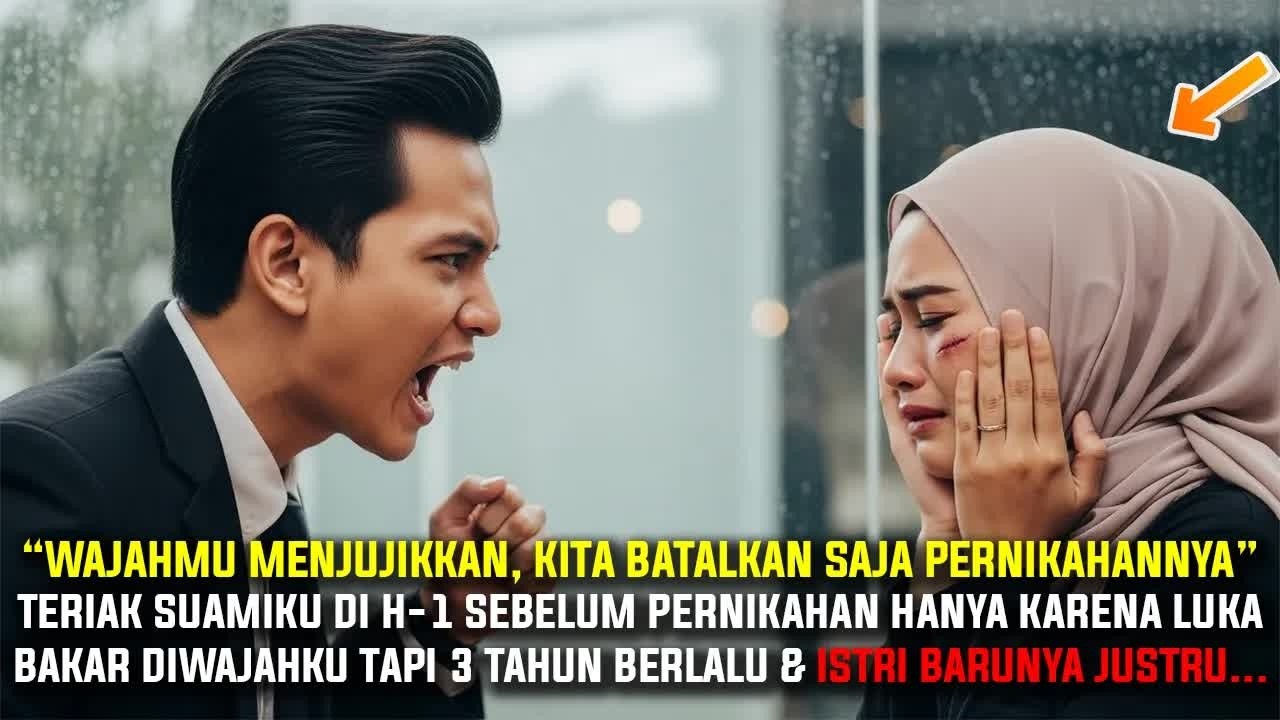 Calon Suami Batalkan Pernikahan H-1 Hanya Karena Luka Bakar di Wajahku, 3 Tahun Kemudian Istrinya…