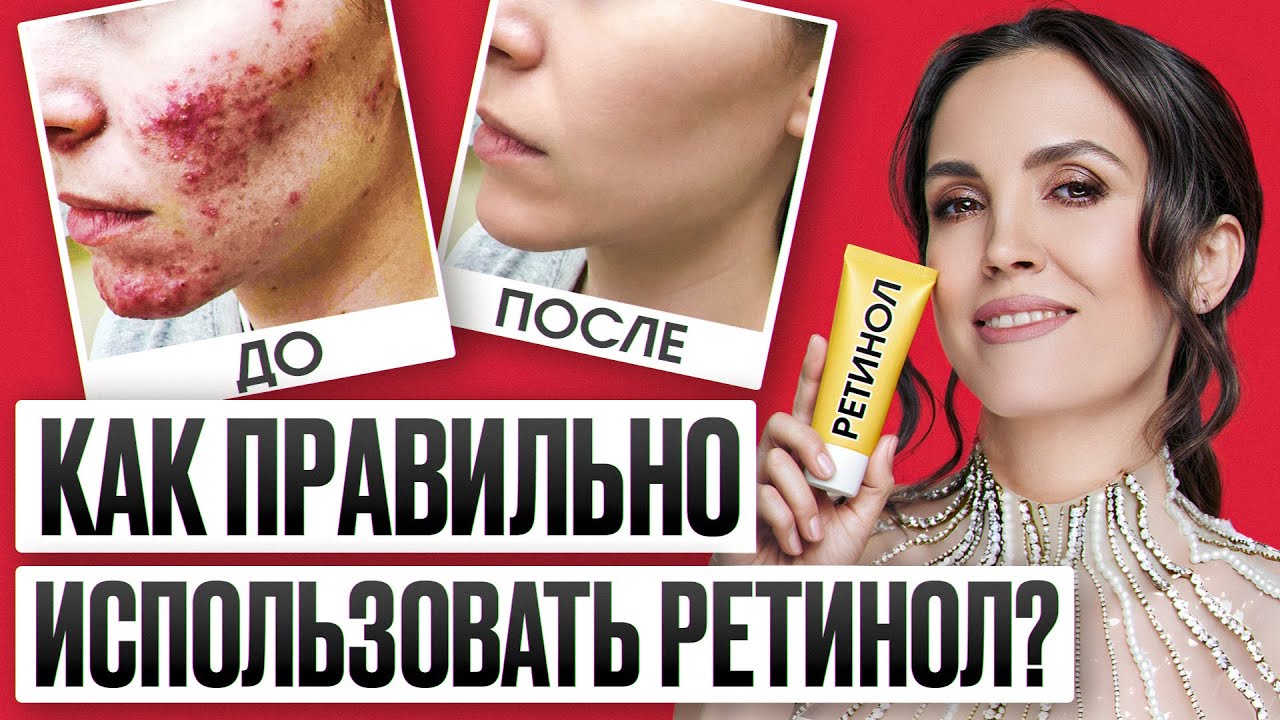 ВСЯ ПРАВДА ПРО РЕТИНОЛ в кремах / НЕ ИСПОЛЬЗУЙ ИХ ПОКА НЕ ПОСМОТРИШЬ ВИДЕО