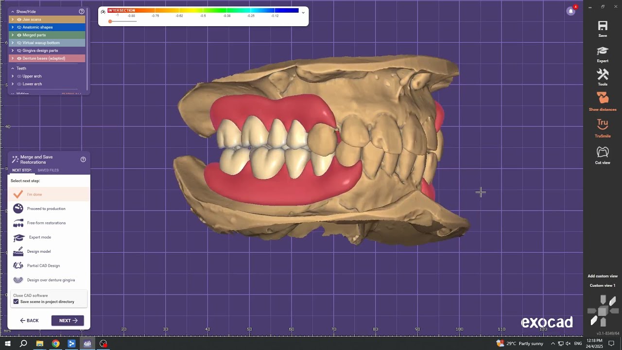Exocad Flexible Denture Design For Upper & Lower Arch (8/8 Teeth)