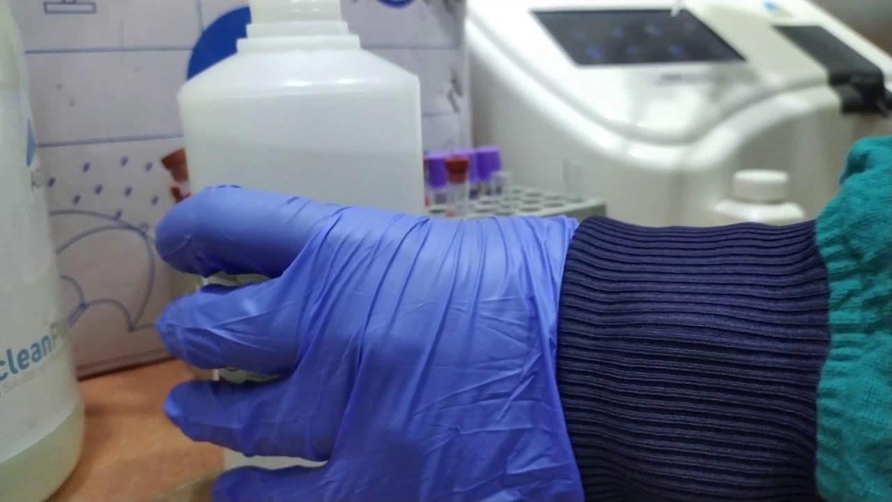 Diluent a sgpt test