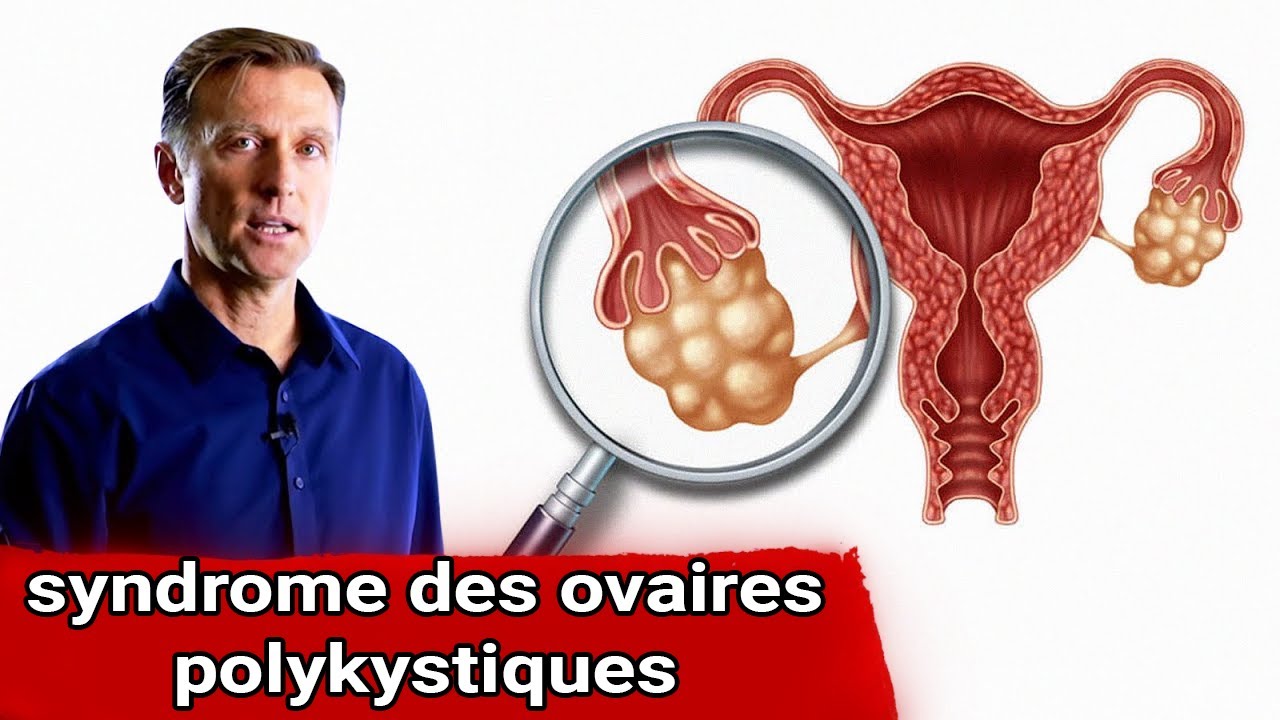 Dr Eric Berg : syndrome des ovaires polykystiques | Sympt&ocirc;mes | Causes