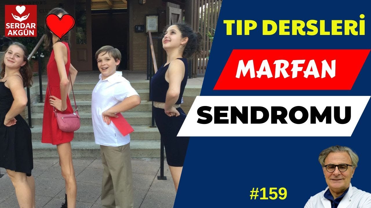 159. Marfan Sendromu nedir? , Kardiyoloji, Tıp Fakültesi