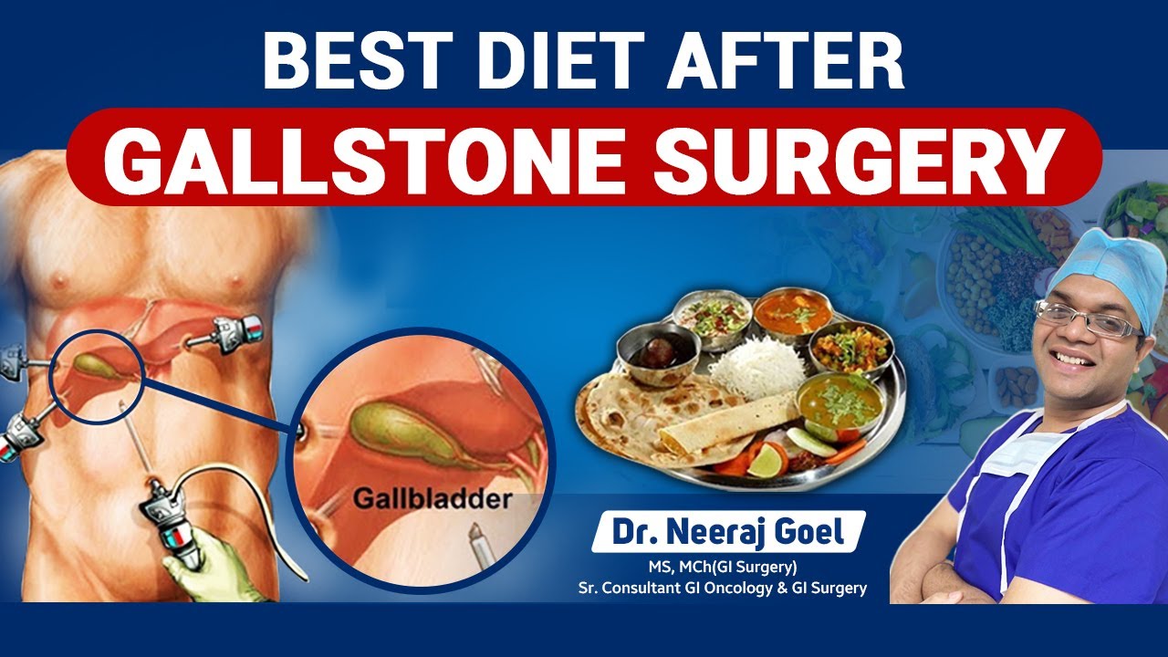 Best diet after gallstone surgery! जानिये डॉक्टर से।
