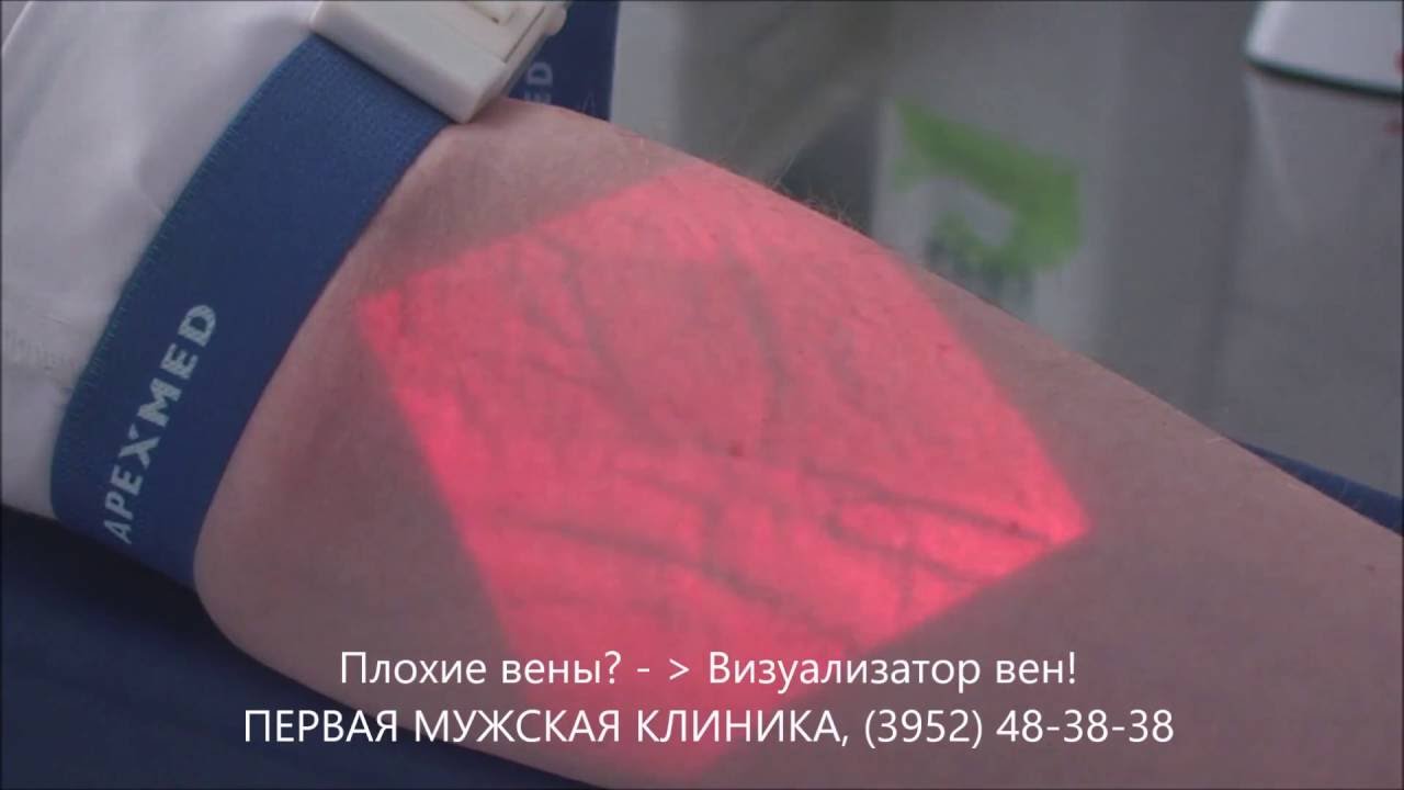 ВИЗУАЛИЗАТОР ВЕН