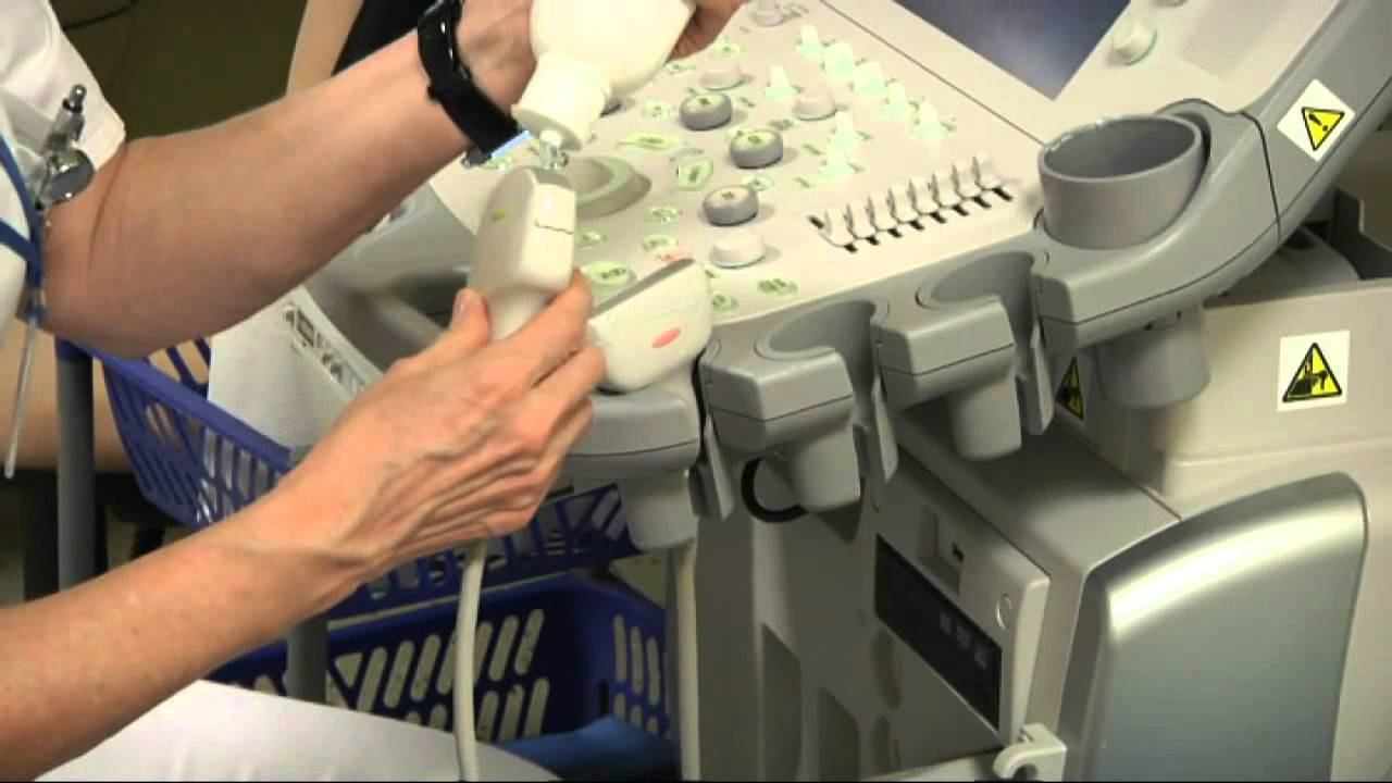 Kompletn&iacute; mamologicko mamografick&eacute; pracovi&scaron;tě pro vy&scaron;etřen&iacute; prsu v FN Kr&aacute;lovsk&eacute; Vinohrady