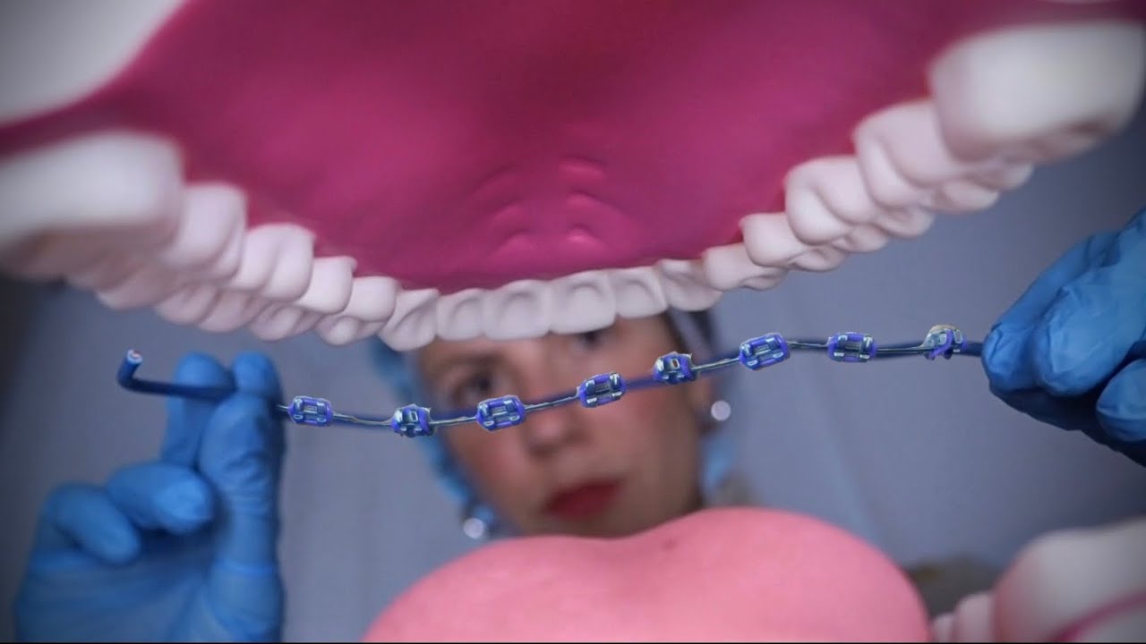 ASMR | DENTISTA COLOCA APARELHO FIXO EM VOCÊ 