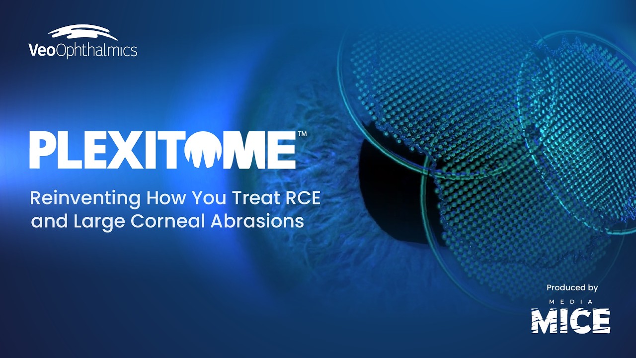 Plexitome™: Reinventing How You Treat RCE and Large Corneal Abrasions