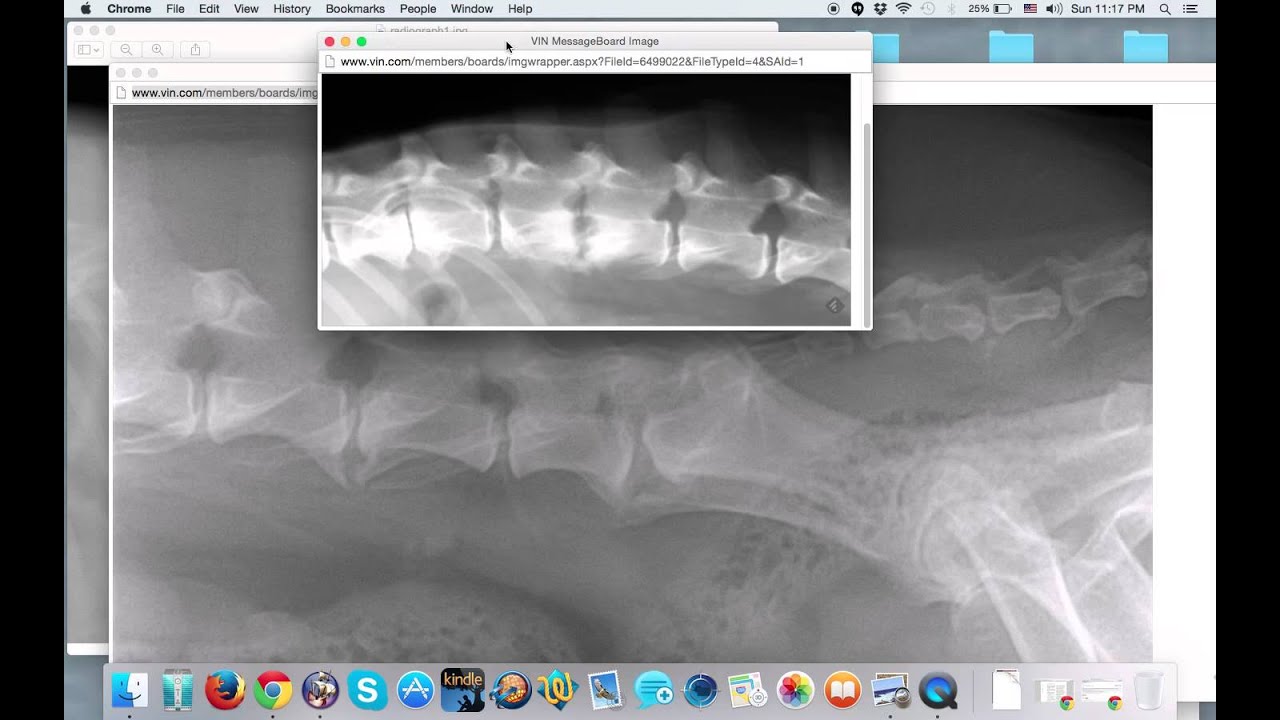 Spondylosis Deformans vs Discospondylitis