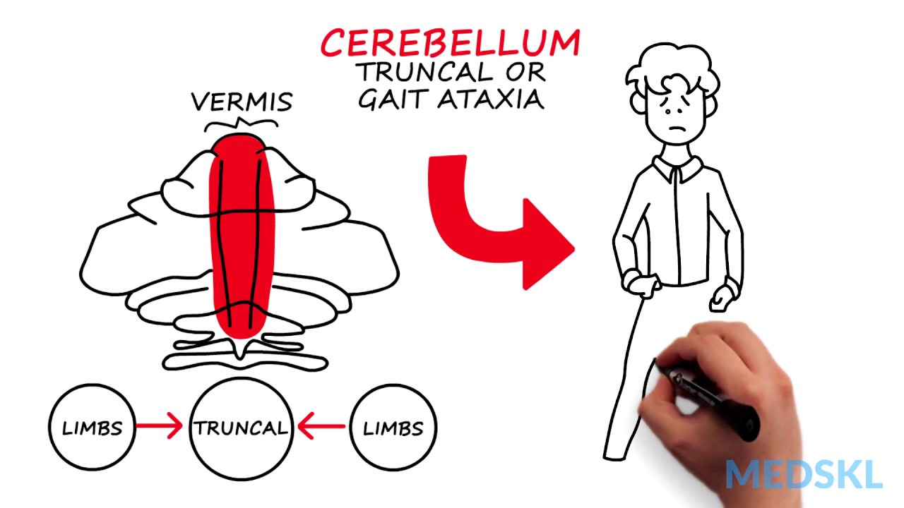 Neurology – Ataxia (Gait) – By Wendy Stewart M.D.