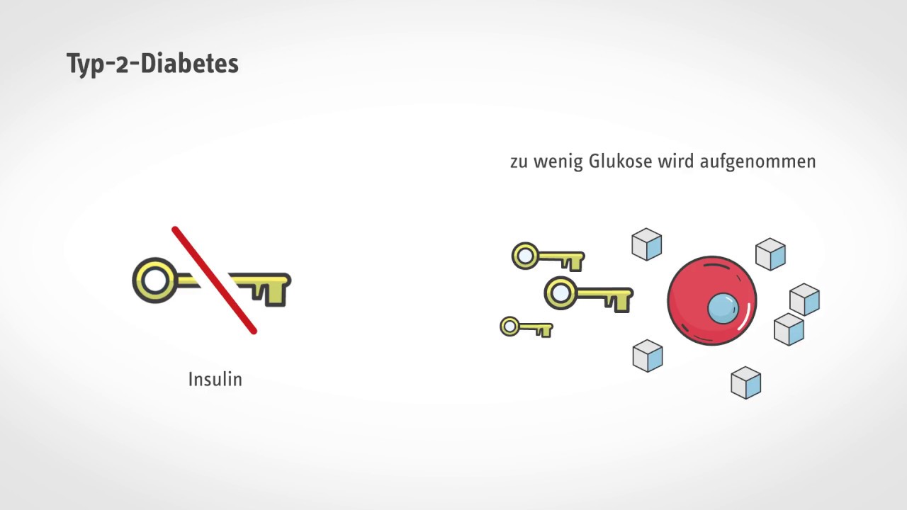 Kurz und verst&auml;ndlich: Was passiert bei Diabetes?