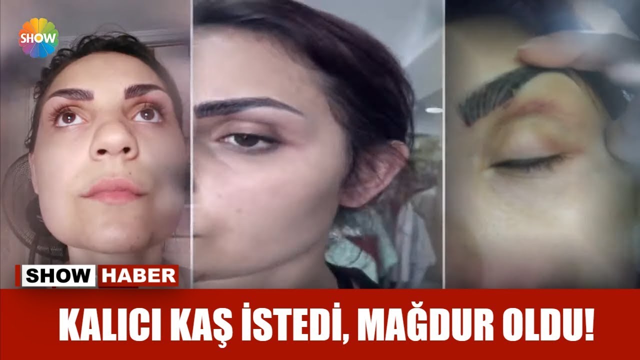 Kalıcı kaş istedi, mağdur oldu!