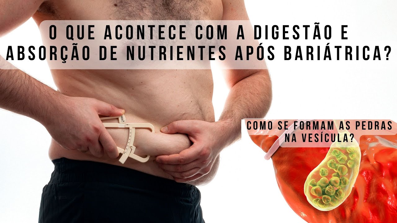 Fala que eu te escuto: como fica a digestão e absorção após cirurgia bariátrica?