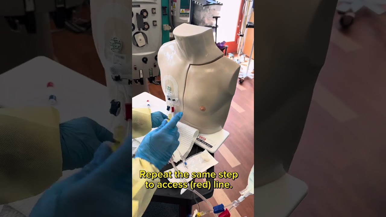 CRRT Blood Recirculation (PrismaFlex) machine
