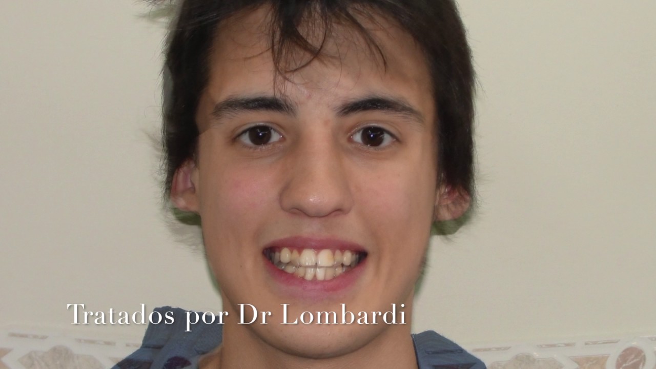 Cuando la Odontologia  cambia rostros.