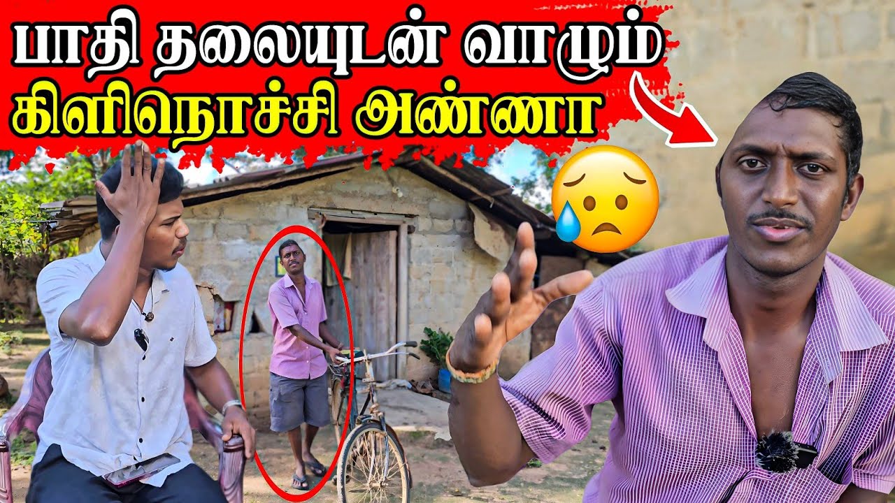 பாதி தலையுடன் கொடுமையான வாழ்க்கை வாழும் அண்ணா | RJ Tamizha