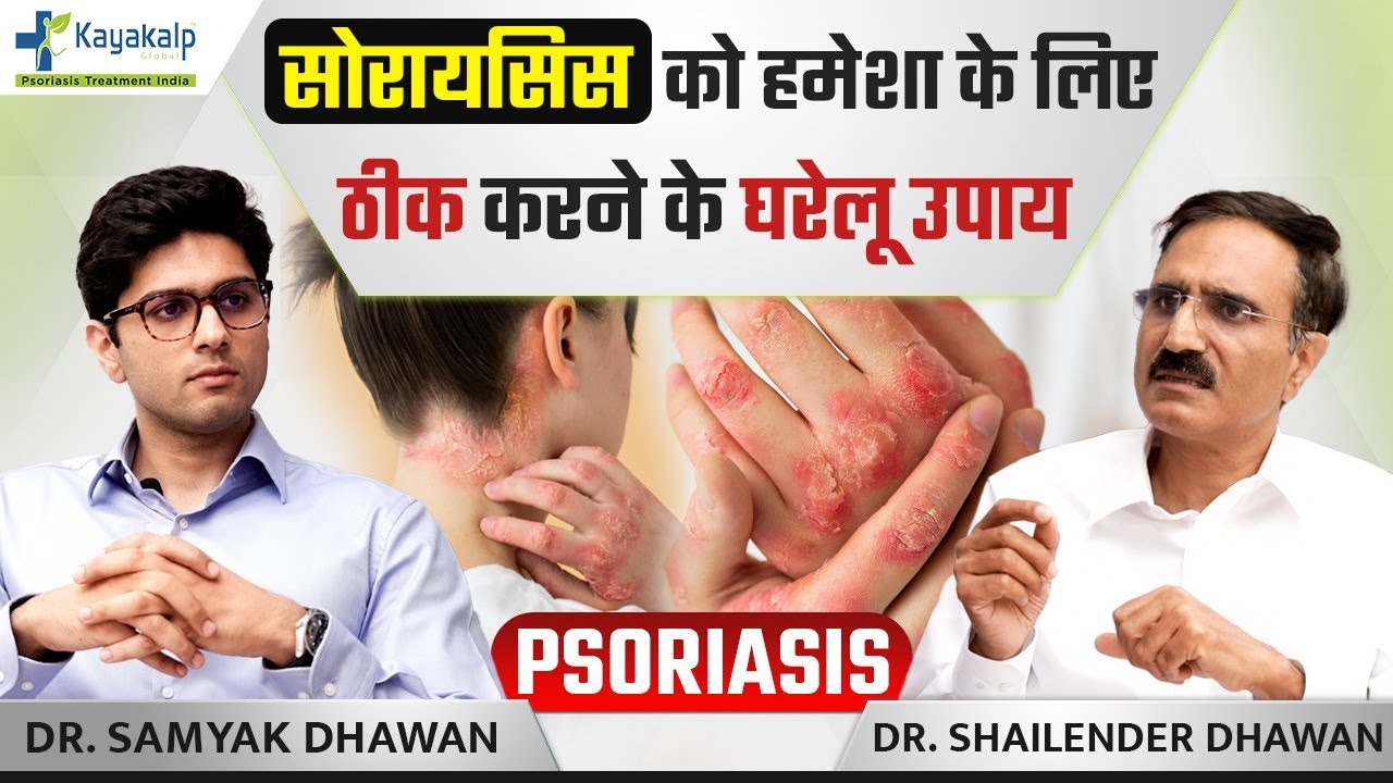 सोरायसिस के घरेलू उपचार/नुस्खे | Best Home Remedies for Psoriasis in India |#PsoriasistreatmentIndia