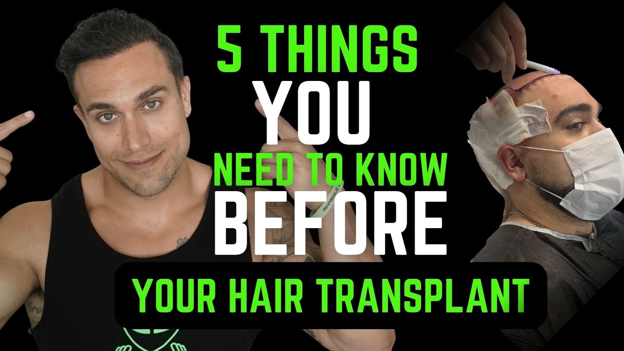 5 Must Knows Before You Get A Hair Transplant Surgery!