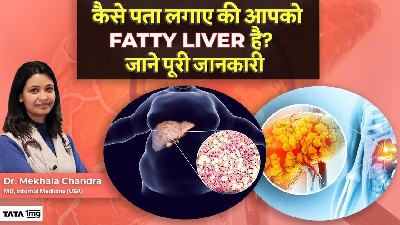 कैसे पता लगाएं की आपको Fatty Liver है? जाने इसके इलाज और बचाव