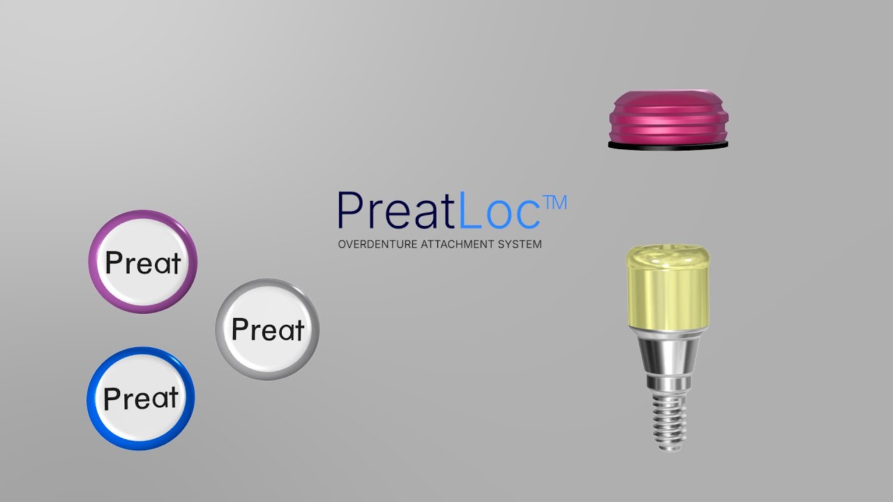 Как использовать PreatLoc™ при реставрации съемного протеза на двух имплантатах