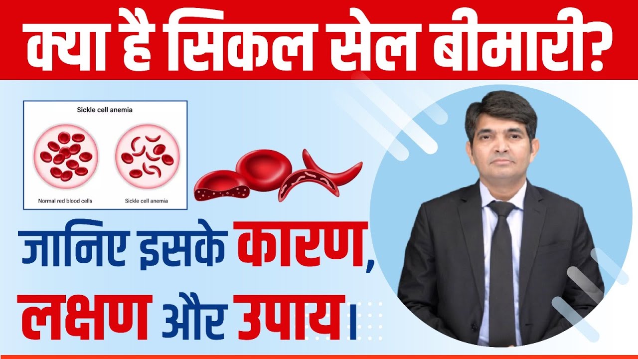 What Is Sickle Cell Disease? सिकल सेल रोग क्या होता है? | Dr. Atish Bakane