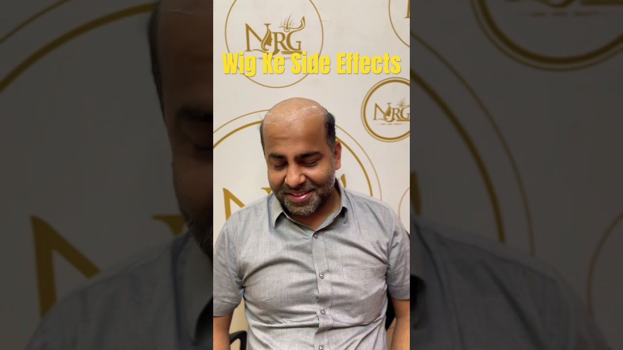Wig Side Effects EXPLAINED | Hair Fall, Itching, Scalp Damage? | Must Watch Before You Wear One!