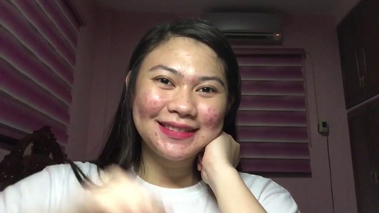 #MaxiPeelJourney | Day 30: Monthsary with Maxi Peel!