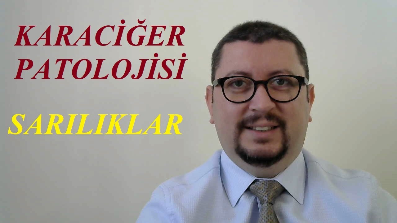 Sarılıklar