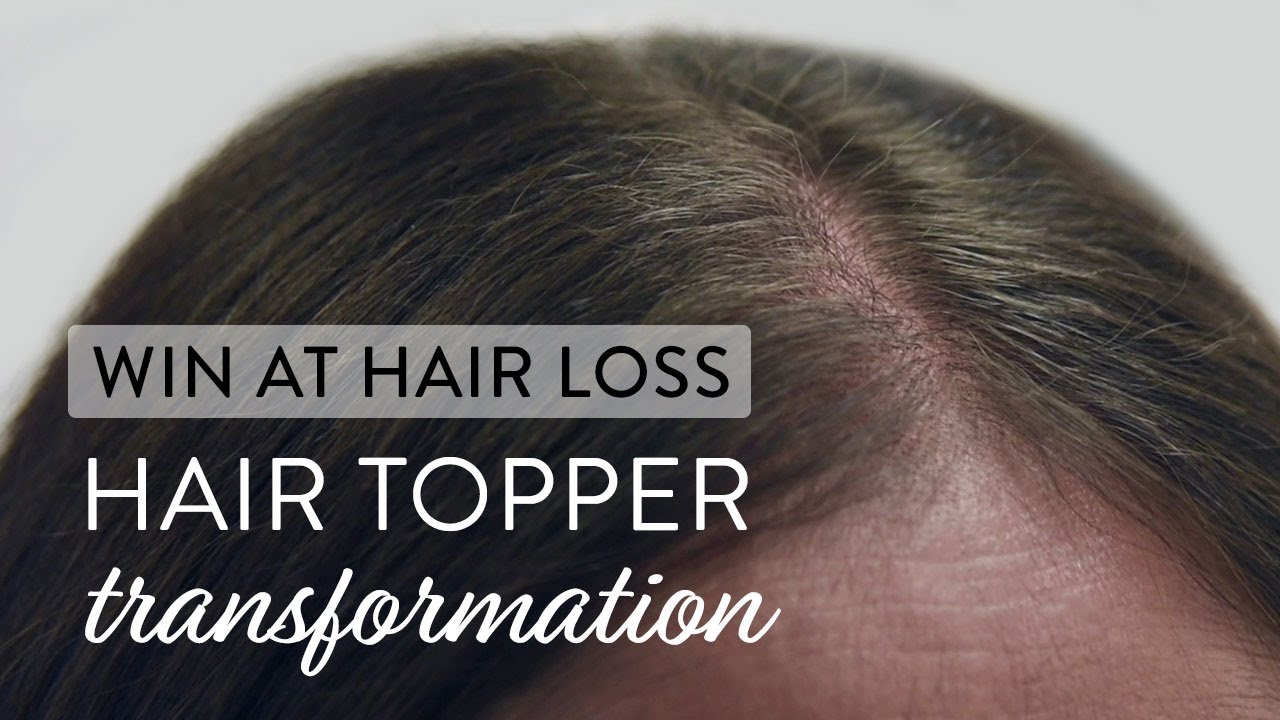 The Long-Lasting Solution for Thinning Hair