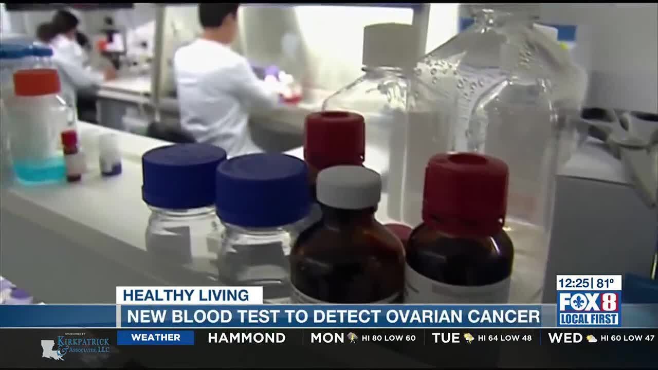 New blood test to detect ovarian cancer