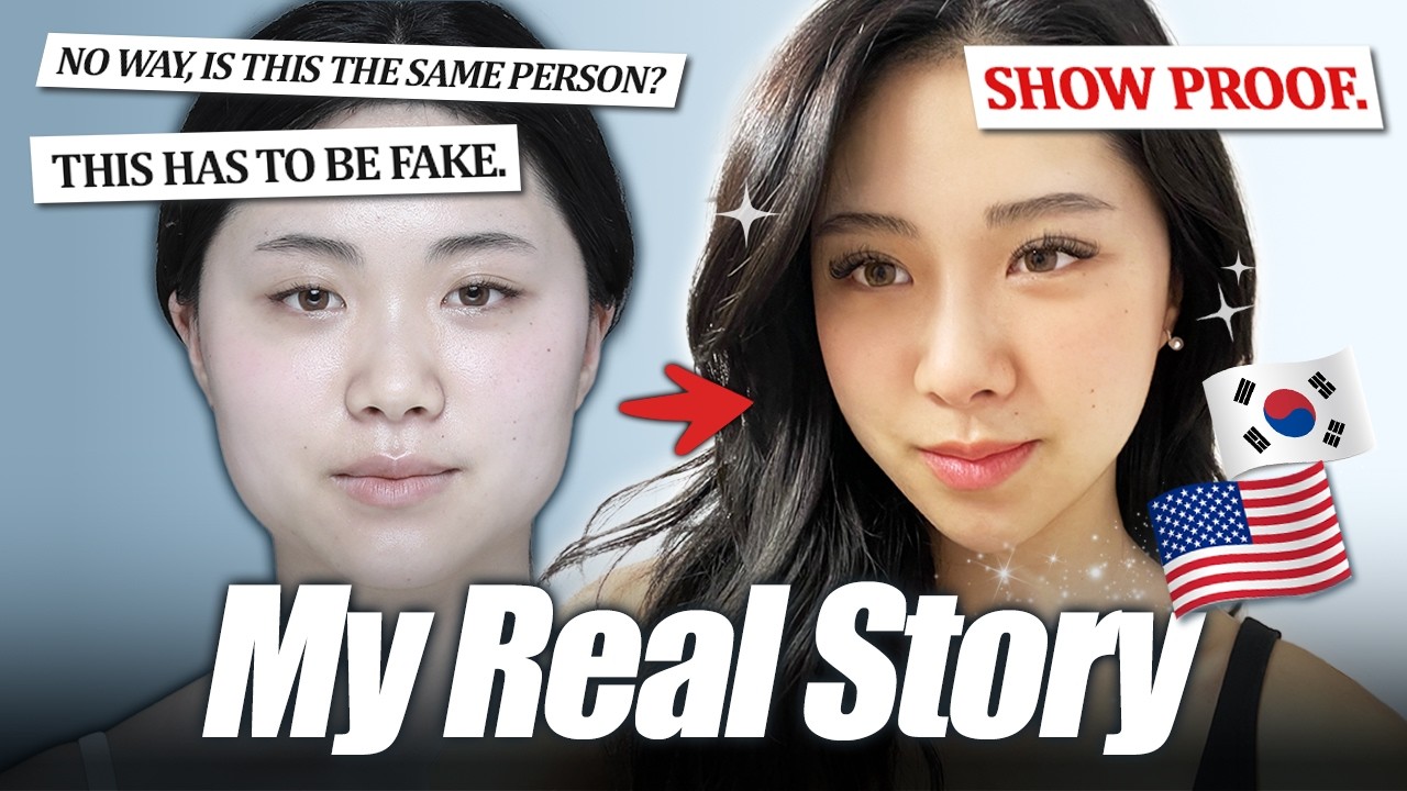 Our Most Popular Surgery Model Ann Lee's FULL Transformation Journey 😱 (1 Year Reveal!)| Braun
