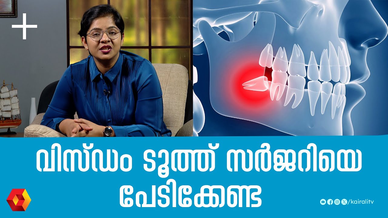 വിസ്ഡം ടൂത്ത് റിമൂവൽ സർജറിക്ക് വലിയ വേദനയാണോ  | Wisdom Teeth Extraction | Wisdom tooth pain | dental