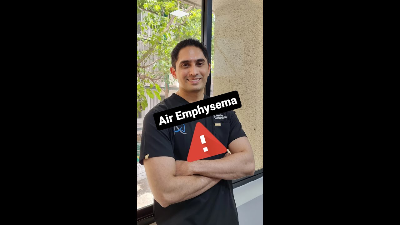 Subcutaneous Air Emphysema